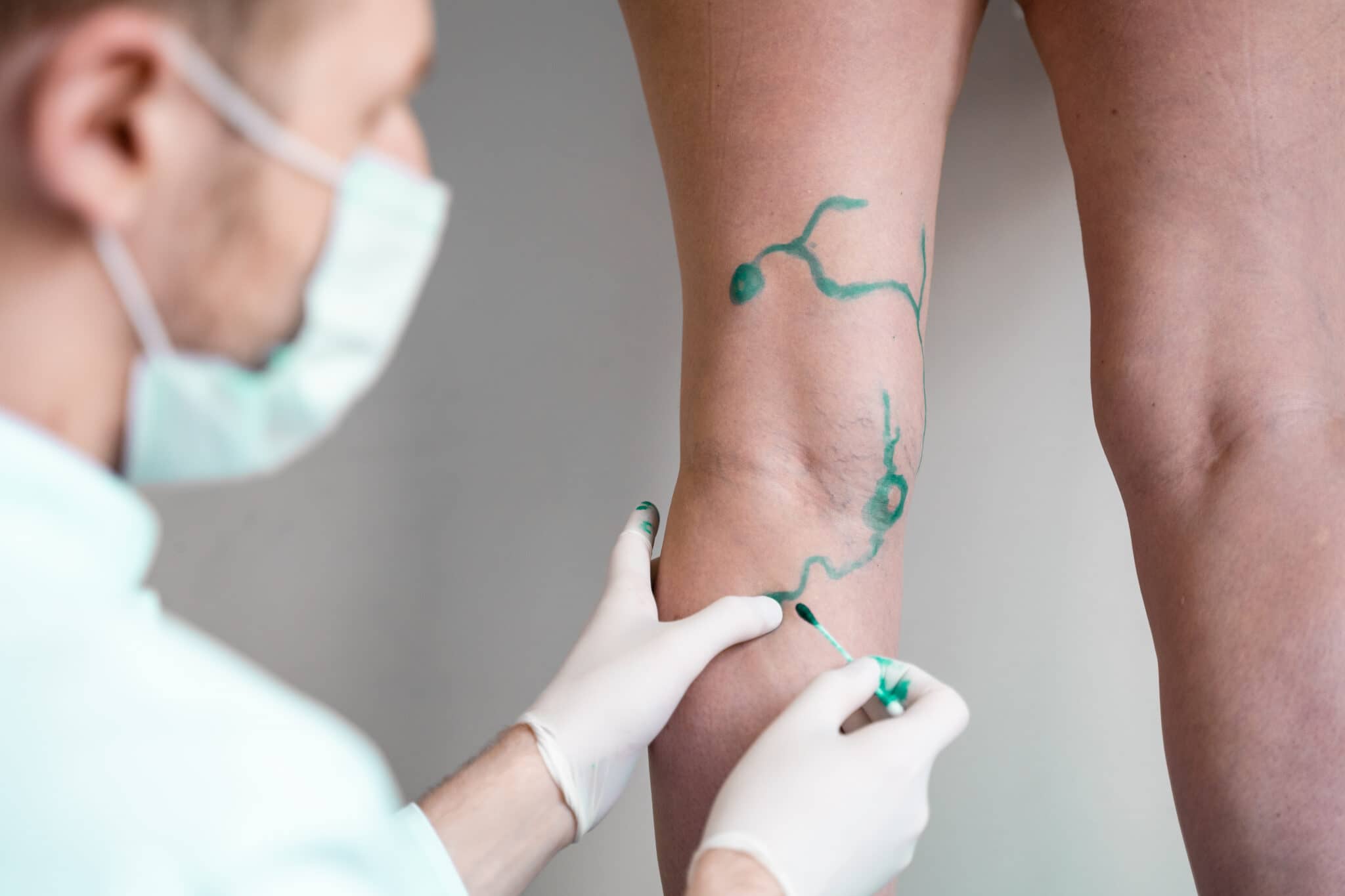 Visita_angiologica_ToscanoMedical