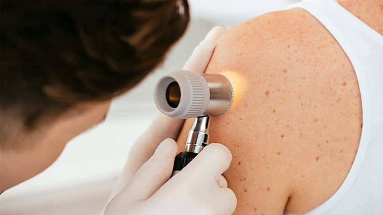 dermatologia-dermatologo-a-frosinone-cavoni-bosone
